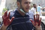 قتيل في اشتباكات بين مؤيدين ومعارضين لمرسي بمدينة مصرية